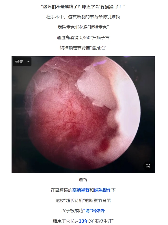 微信截图_20250307091703.png